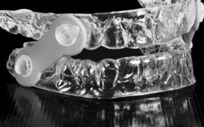 Conozca más sobre los dispositivos de avance mandibular